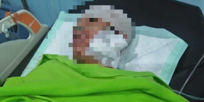 
					Korban Pembacokan Terbaring di Rajang Rumah Sakit. Foto: ist