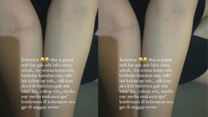 
					Salah satu postingan menunjukkan lengan yang tidak terjadi apa-apa. (Ft.dok)